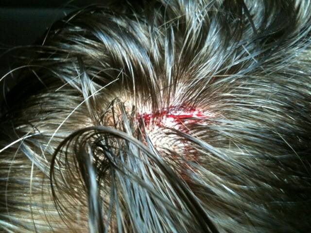 Busted head.jpg