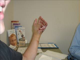 hand1_0001.jpg
