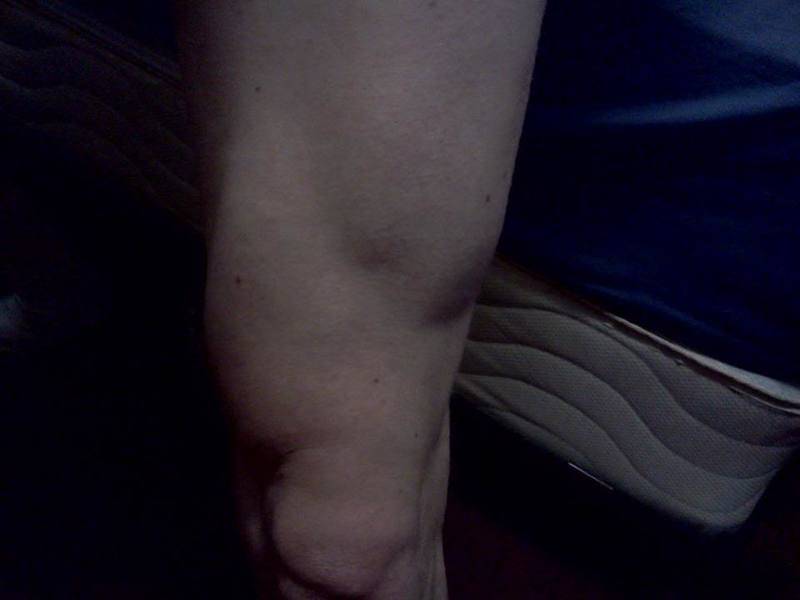 Legs-13months.jpg