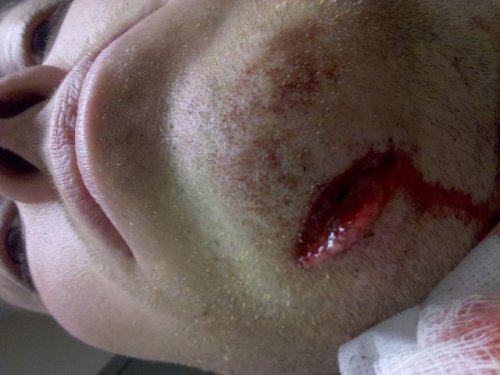 accident.jpg accident.jpg